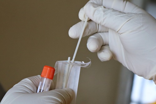 Μοριακό test ανίχνευσης του νέου κορωνοϊού SARS CoV–2  (PCR) στα Νοσοκομεία του ΟΚΥπΥ